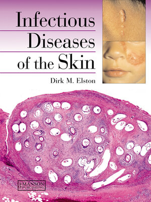 cover image of Infectious Diseases of the Skin